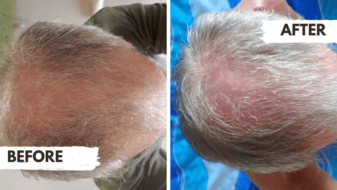 Regrow Review – Duncan