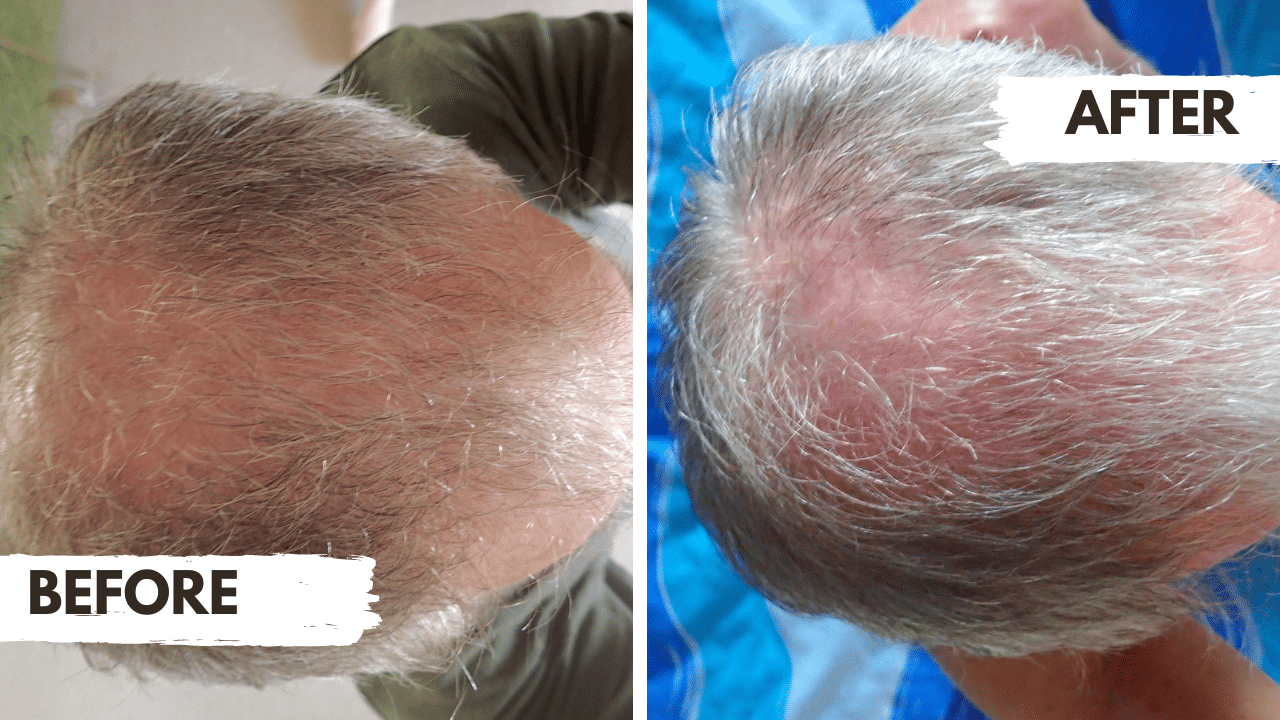 Regrow Review – Duncan