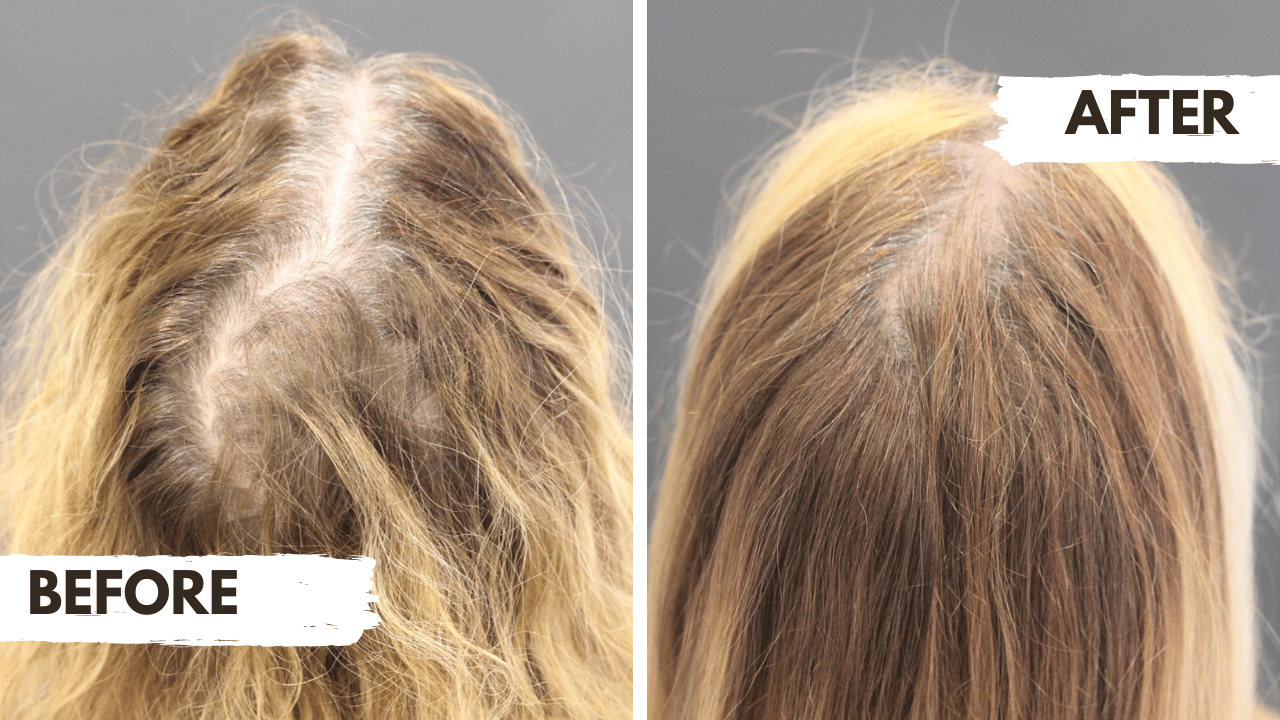 Regrow Review – Coralie