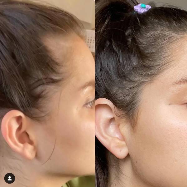 REGROW hair products