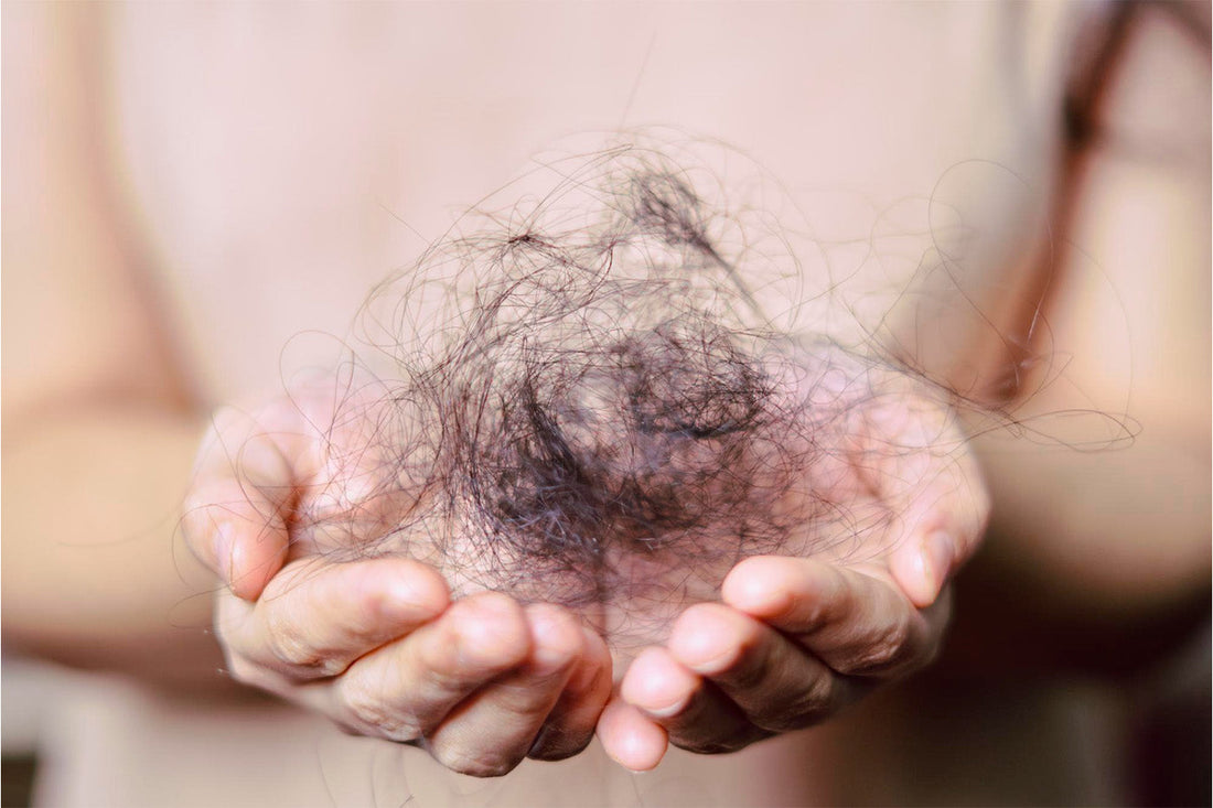 How Much Hair Loss Is Normal?