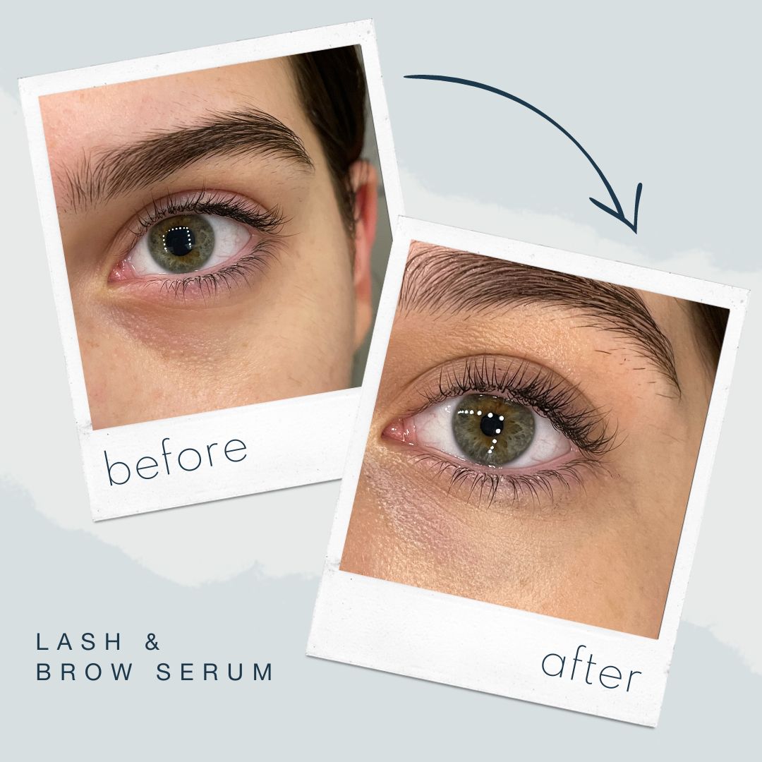 Lashserum Beforeafter